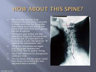CHIROPRACTIC GROUP REPORT OF FINDINGS   SEE300AWEEK   2 CDs w/ AUDIO 