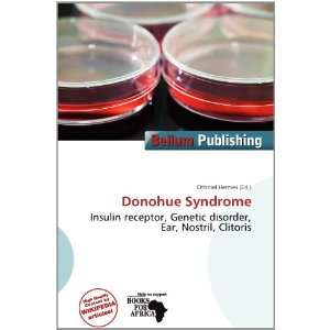  Donohue Syndrome (9786200769411) Othniel Hermes Books