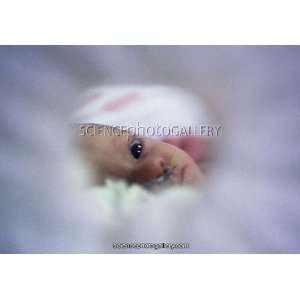  Premature baby in incubator with nasogastric tube Canvas 