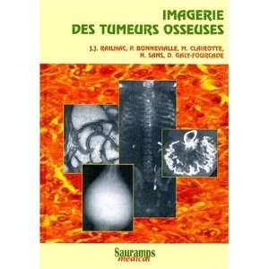  imagerie des tumeurs osseuses (9782840232155) Railhac 